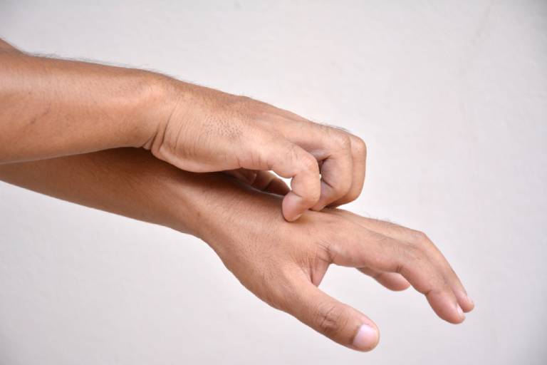 Bị ngứa châm chích dưới da: Nguyên nhân và cách chữa khỏi