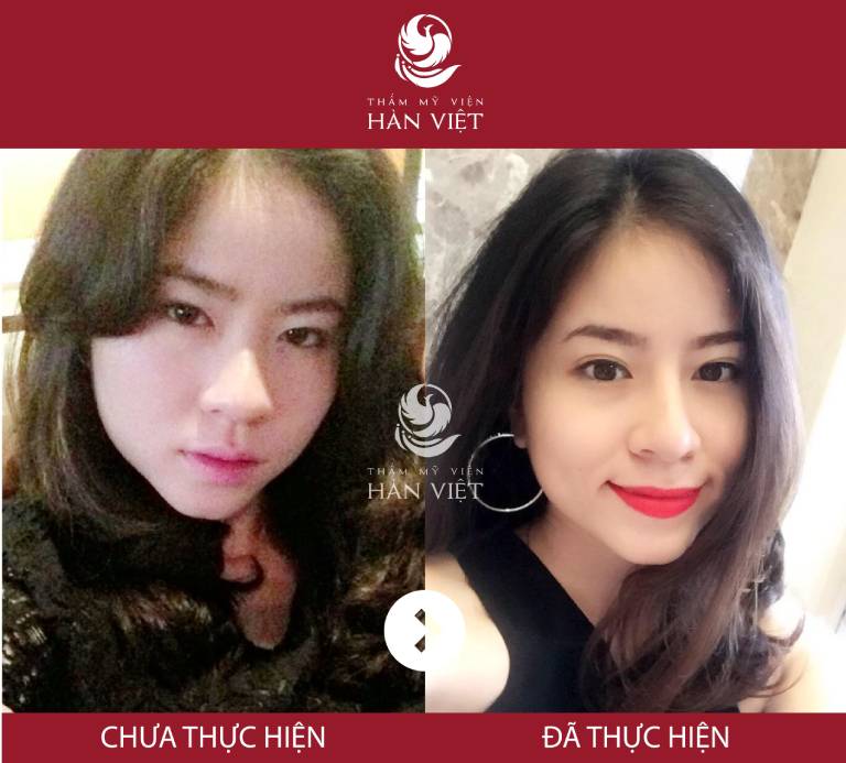 Thẩm mỹ viện Hàn Việt