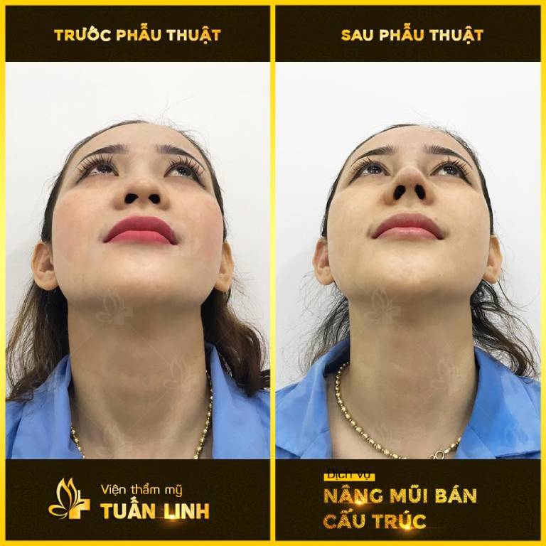 Thẩm mỹ viện Tuấn Linh