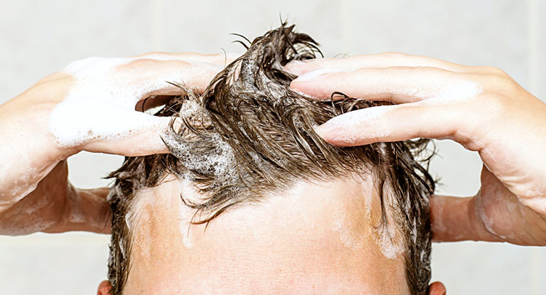 viêm da dầu có gây rụng tóc
