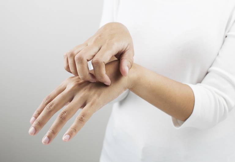 Nổi mẩn ngứa khi trời nóng: Cách điều trị và phòng ngừa