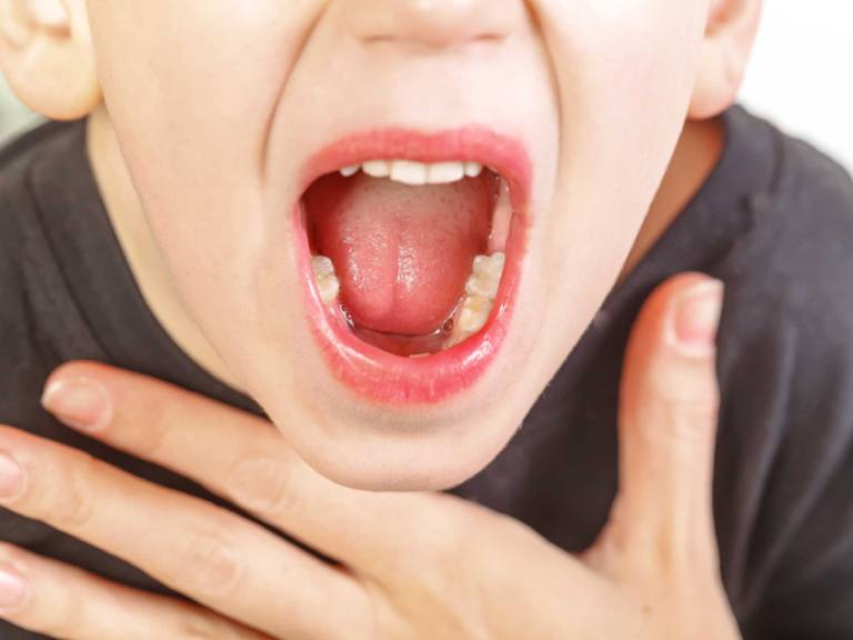 Bệnh viêm họng nguy hiểm không?