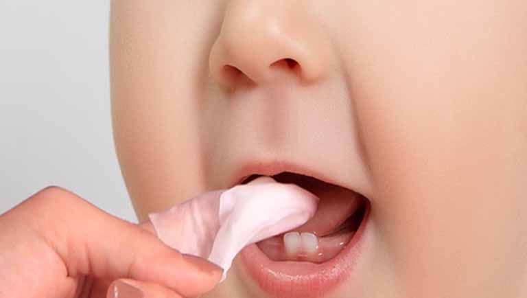 Tại sao trẻ sơ sinh cần phải rơ lưỡi?