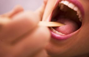 Viêm họng mãn tính: Triệu chứng và cách chữa trị
