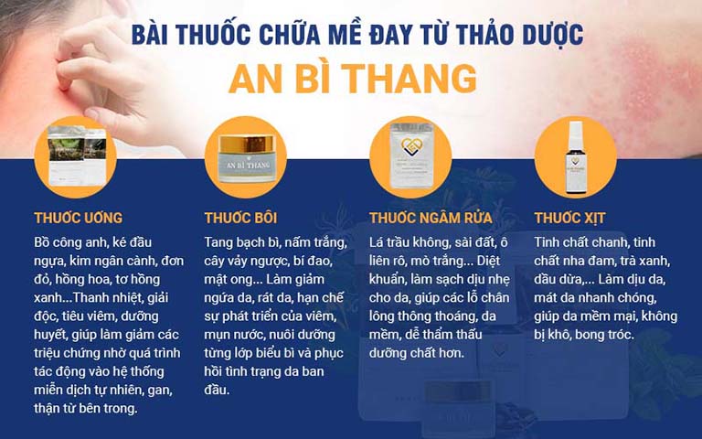 Những chế phẩm được sử dụng để điều trị mề đay, dị ứng mẩn ngứa
