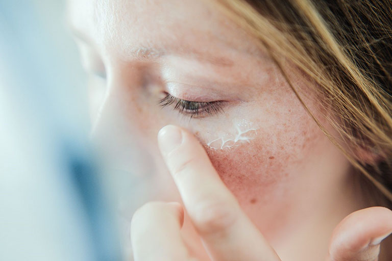 Cách khắc phục da mặt bị khô sần và ngứa