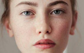 Viêm da tiếp xúc dị ứng ở mặt: Cách xử lý và phòng ngừa