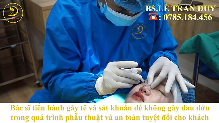 nâng mũi sline có đau không