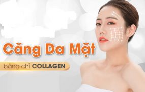 địa chỉ căng chỉ Collagen tại Hà Nội