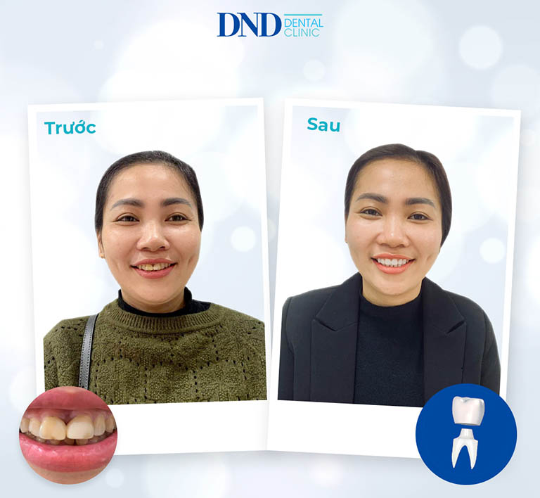phòng khám răng hàm mặt uy tín tại Hà Nội