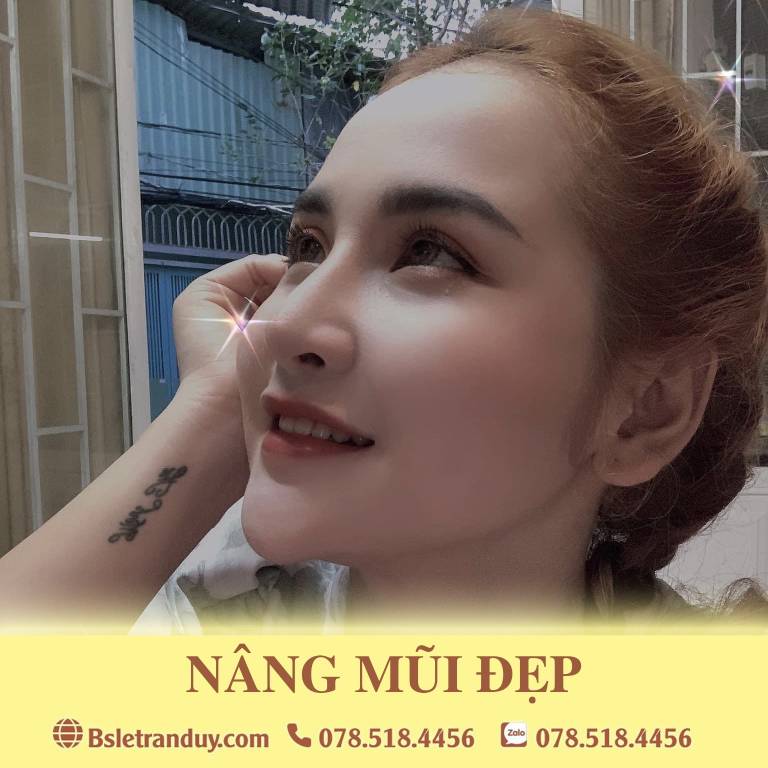 Những loại sụn được dùng trong nâng mũi bọc sụn