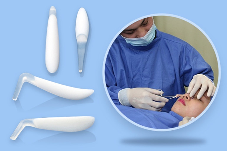 nâng mũi sụn nhân tạo