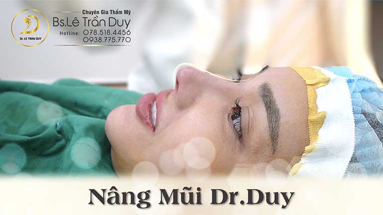 Dr Lê Trần Duy - bác sĩ nâng mũi bọc sụn tại tphcm