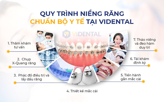 Niềng răng tại Hà Nội Vidental 