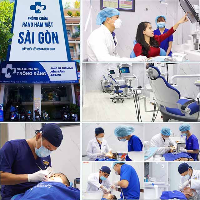 Phòng khám nha khoa trồng răng Sài Gòn uy tín TPHCM 