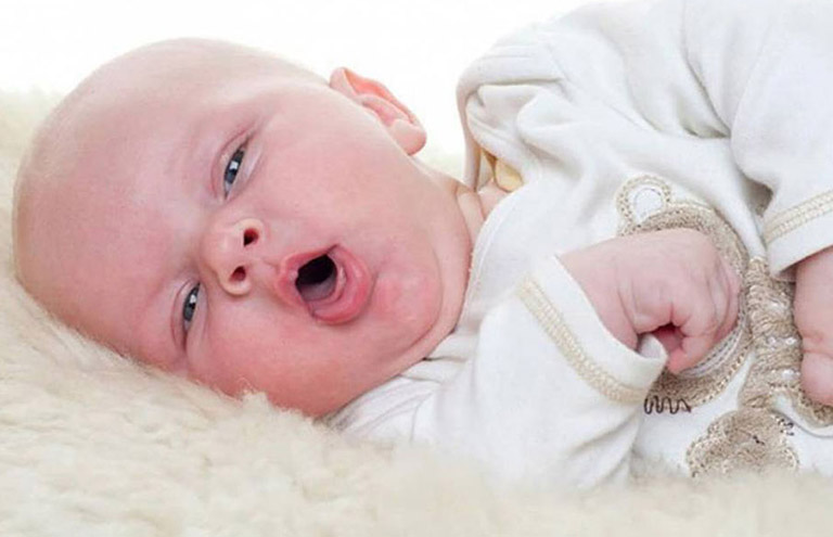 Các dấu hiệu trẻ sơ sinh ảnh hưởng não từ việc rung lắc bé