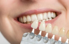 ViDental Clinic - Địa chỉ bọc răng sứ hàng đầu