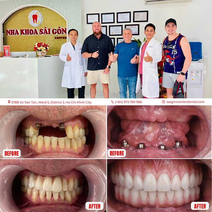 Prestigious Dental Clinic in Ho Chi Minh City