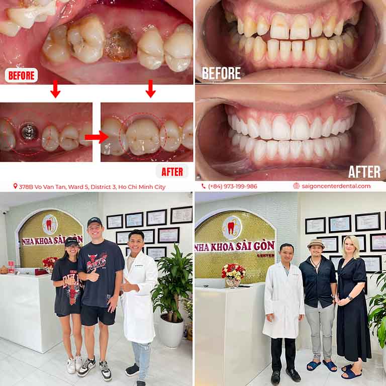 Best Dental Clinics in Ho Chi Minh City